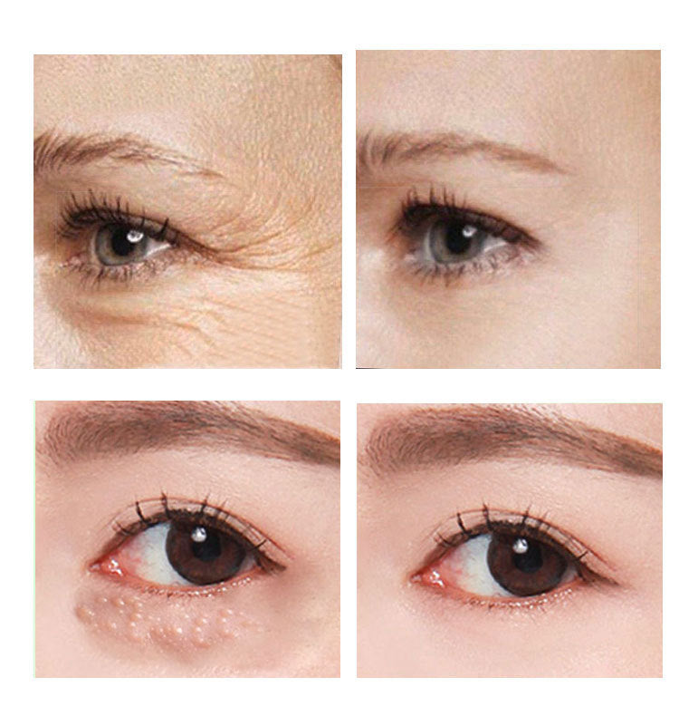 Beauty Eye Cream30mlwish Women'