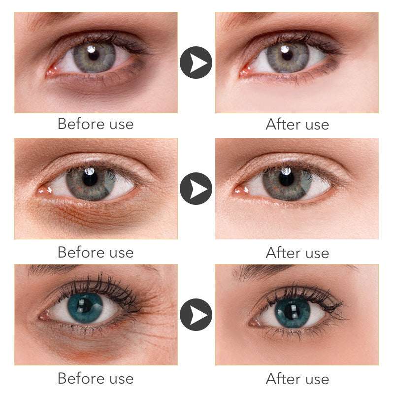 Beauty Eye Cream30mlwish Women'